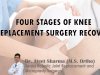 FOUR STAGES OF KNEE REPLACEMENT SURGERY RECOVERY