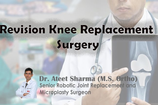 Revision Knee Replacement Surgery