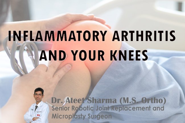 INFLAMMATORY ARTHRITIS AND YOUR KNEES