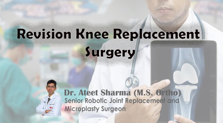 Revision Knee Replacement Surgery - Dr. Ateet Sharma - Senior Robotic ...