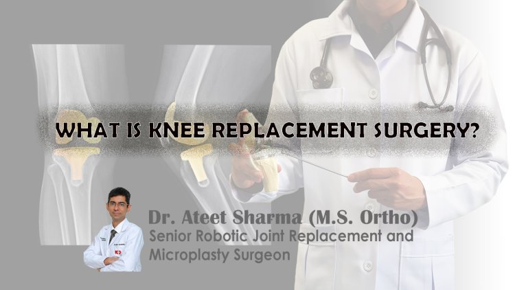 WHAT IS KNEE REPLACEMENT SURGERY?